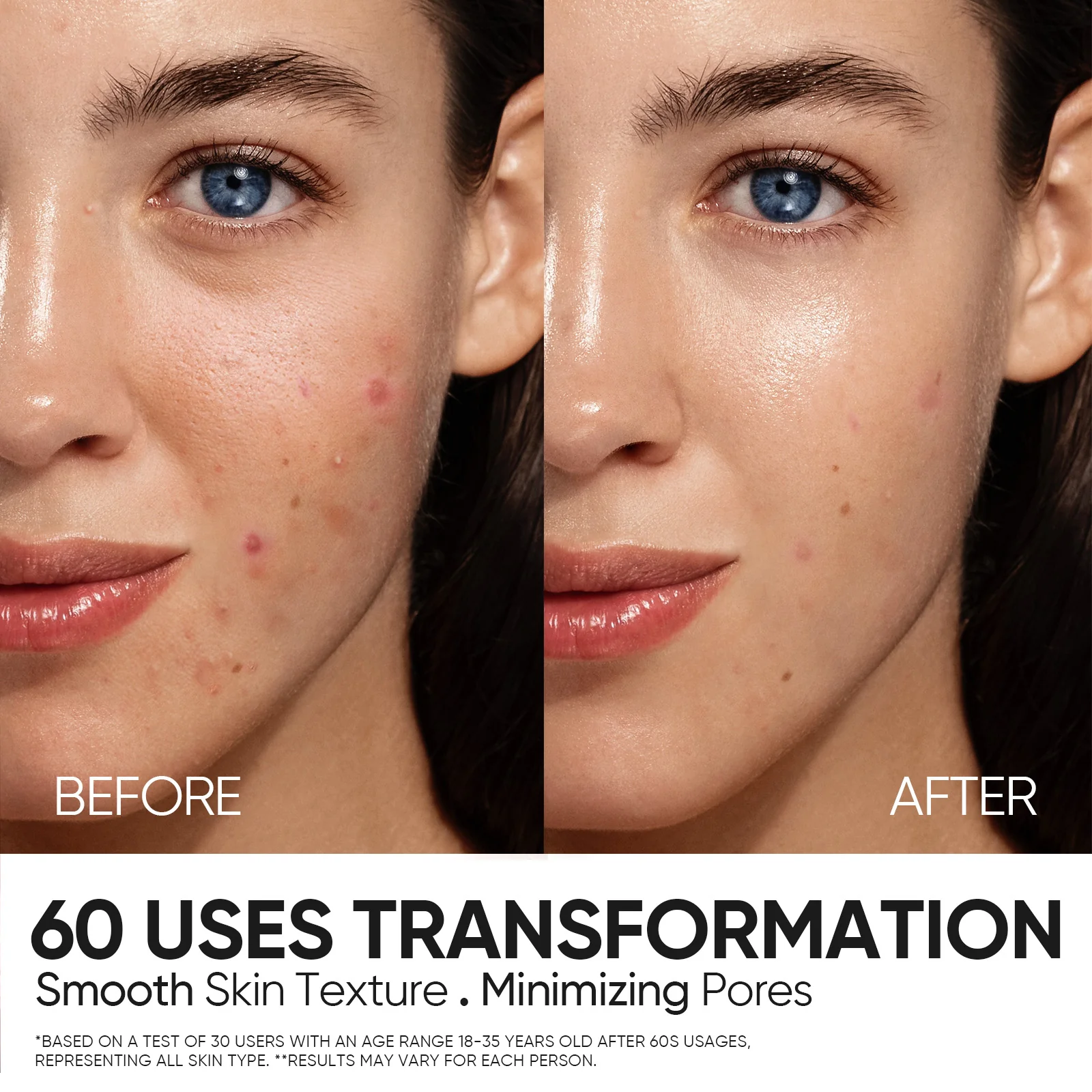 12% AHA BHA PHA LHA Peeling Solution Serum - Image 4