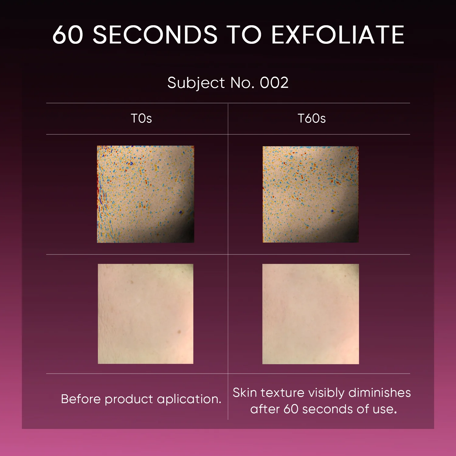 12% AHA BHA PHA LHA Peeling Solution Serum - Image 8