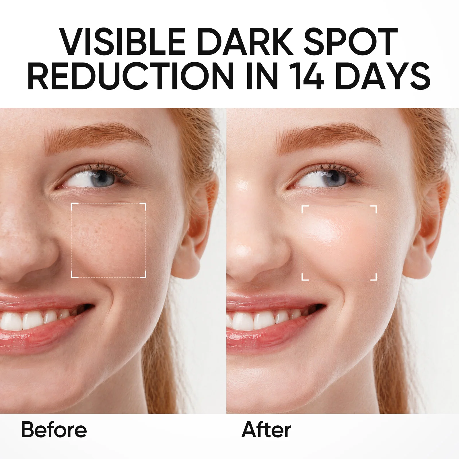 377 Dark Spot Serum - Image 3