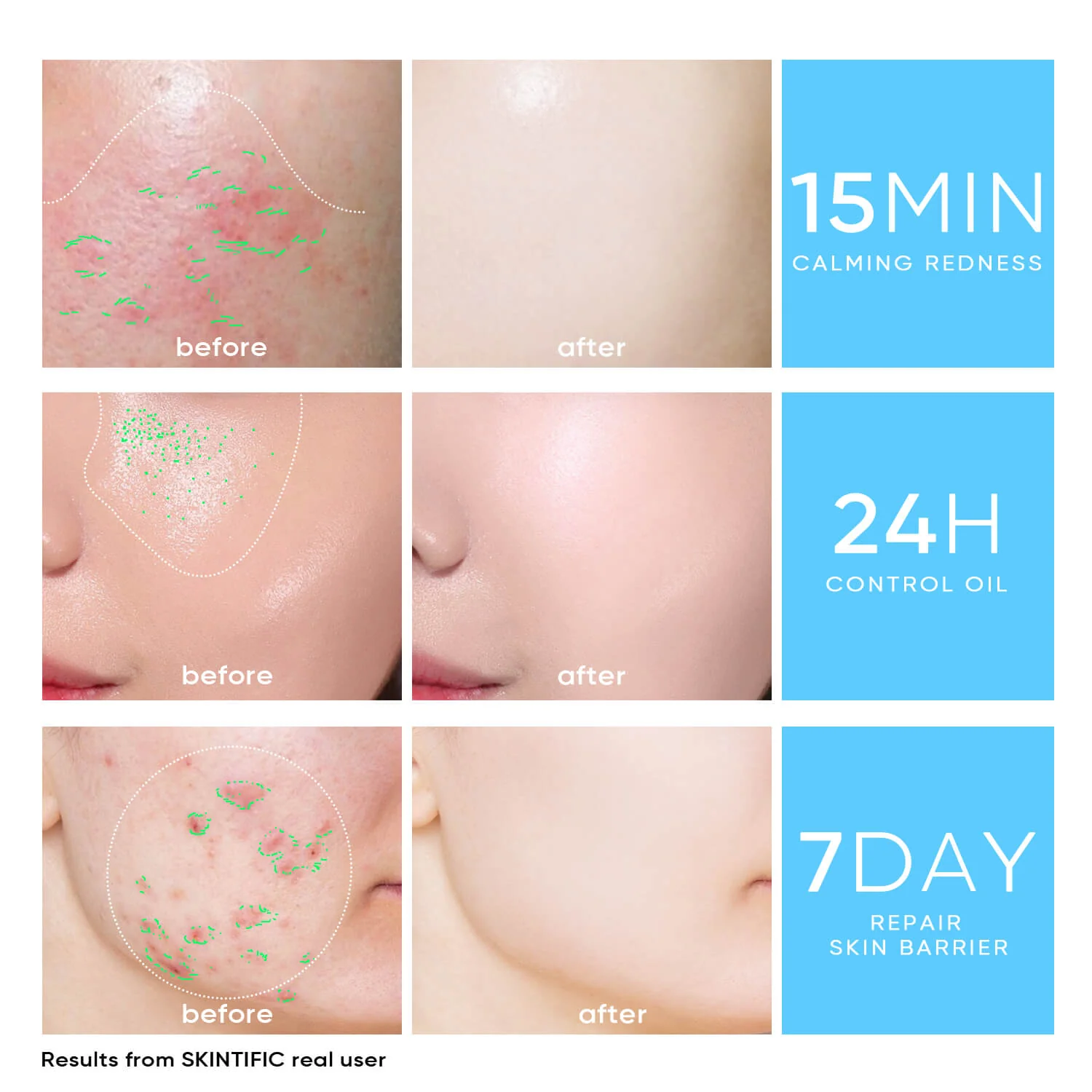 5X Ceramide Barrier Face Moisture Gel Light Texture - Image 4