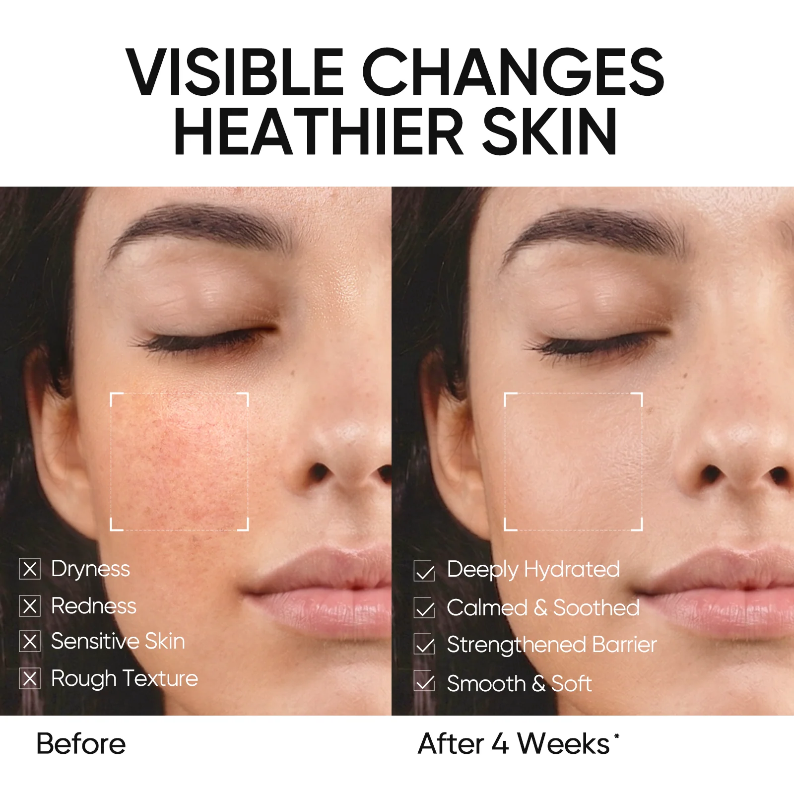 5X Ceramide Barrier Repair Moisture Gel - Image 6