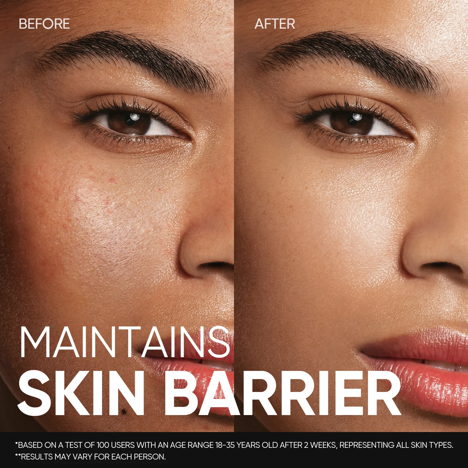 5X Ceramide Soothing Skin Barrier Toner - Image 4