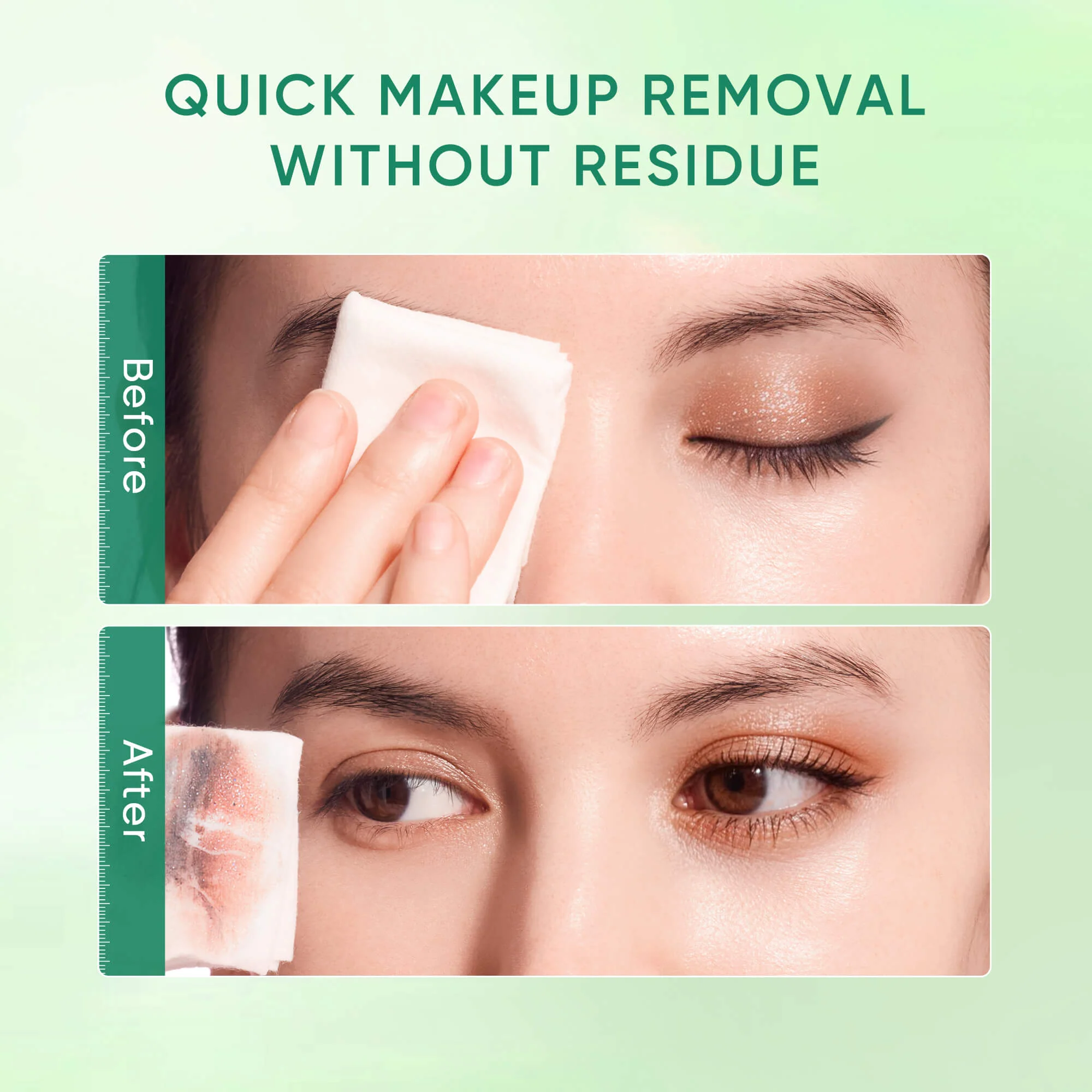 Centella Acne Care Micellar Cleansing Wipes for Acne-Prone Skin - Image 5