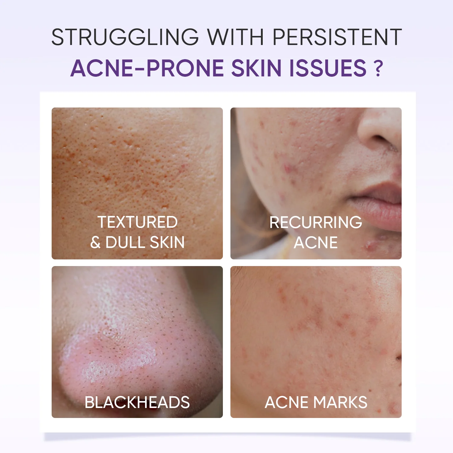 Lactic Acid Exfoliating Serum Smooth & Bright Skin - Image 3