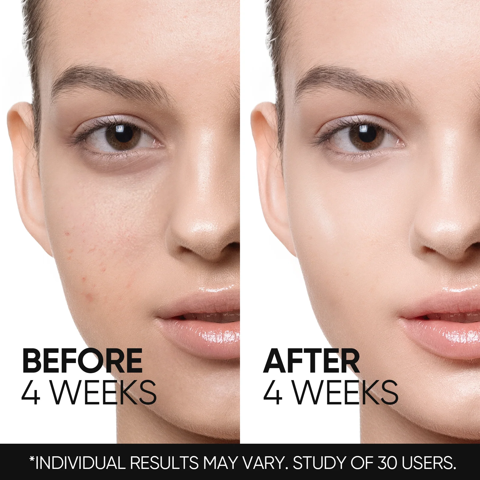 Retinol Skin Renewal Moisturizer Acne & Anti-Aging Night Cream - Image 4