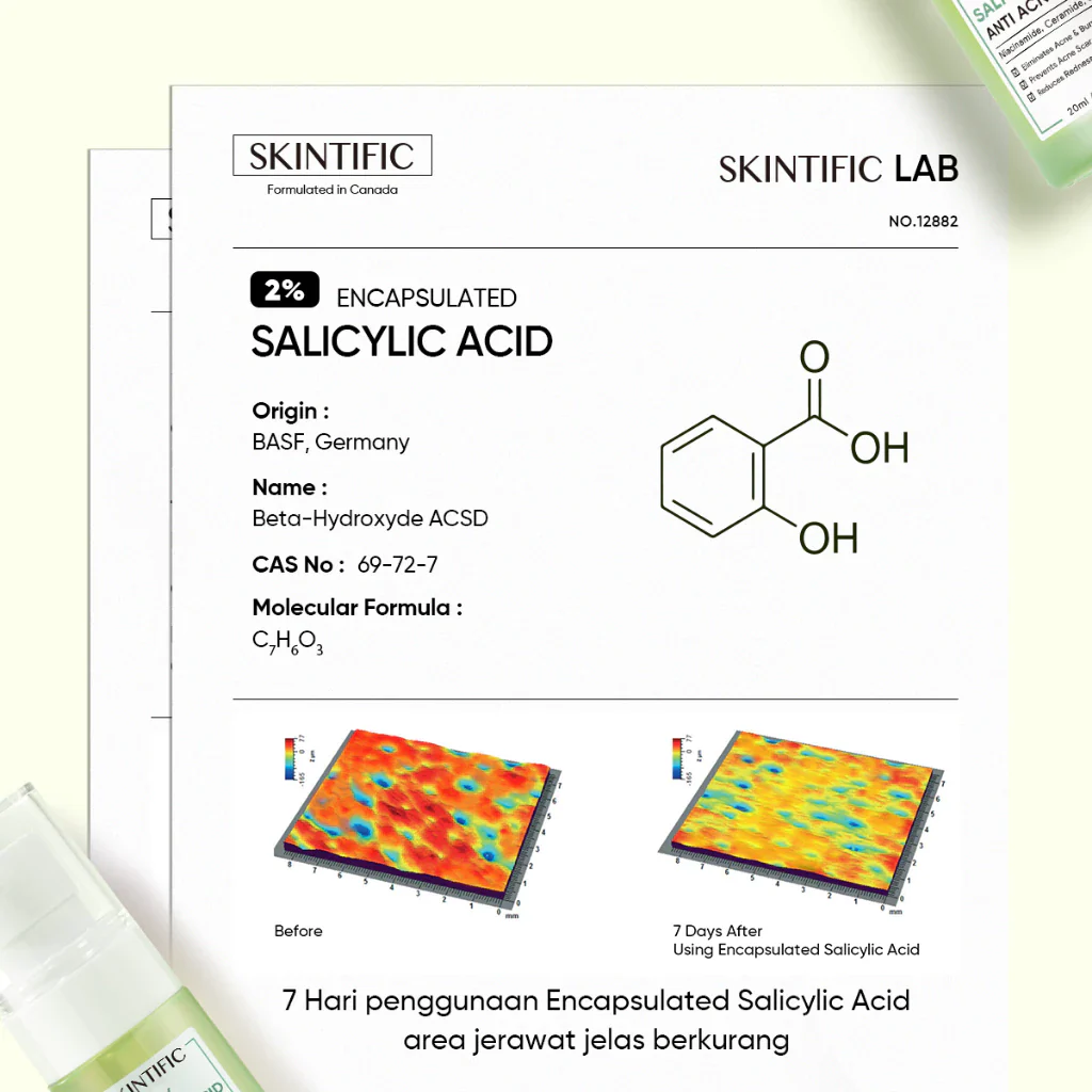 2% Salicylic Acid Serum Acne Treatment & Pore Clearing - Image 4